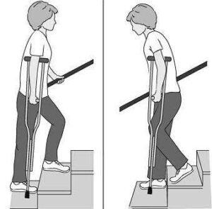 Working the stirs with crutches